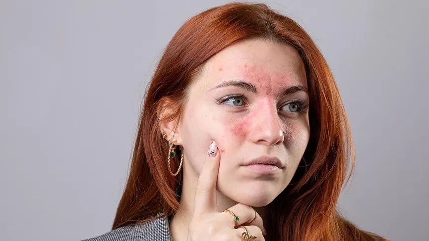 SLE di Tahun 2024: Apa Saja yang Perlu Dipahami&nbsp;Kembali?