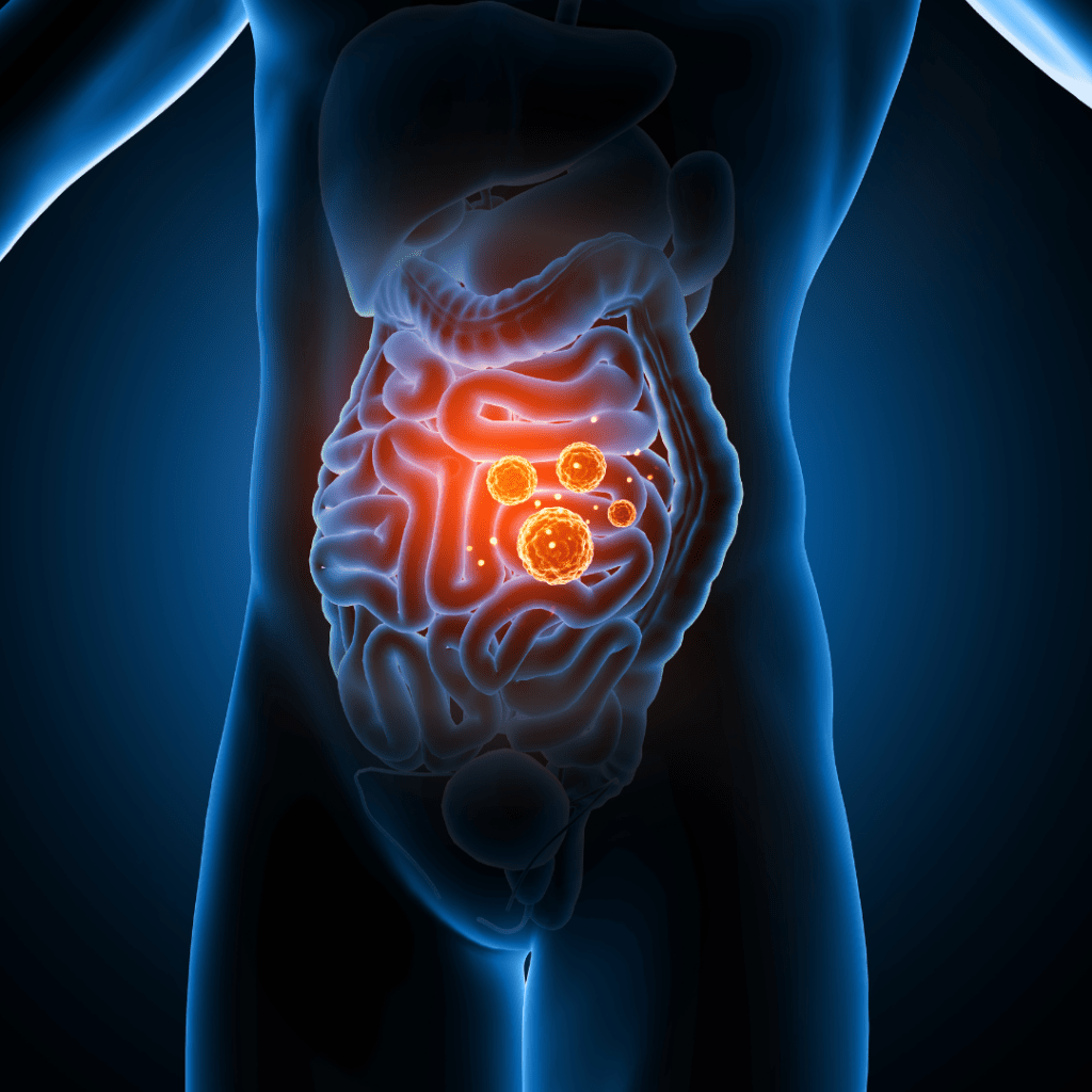 Peran Mikrobiota Usus Pada Perkembangan Penyakit&nbsp;SLE