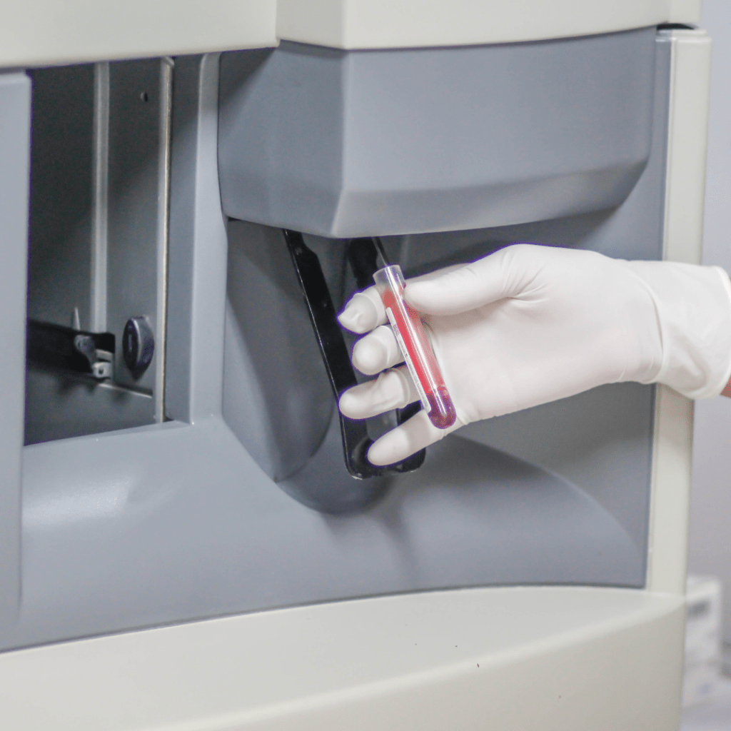 Systemic Immune-Inflammation Index, Biomarker Potensial untuk Menilai Aktivitas Penyakit pada&nbsp;SLE