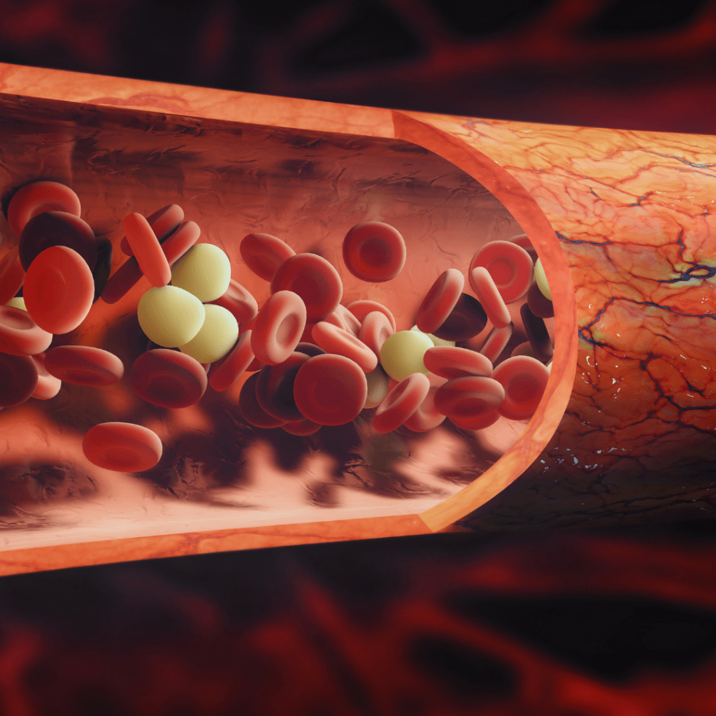 Lupus dan Antiphospholipid Syndrome&nbsp;(APS)