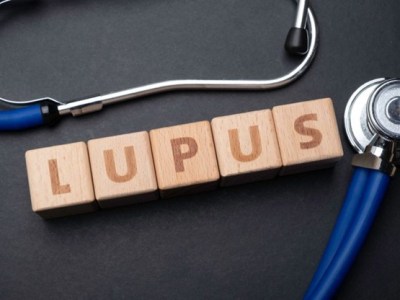 Treat-to-Target (T2T) dan Low Disease Activity State (LLDAS) pada Lupus Eritematosus&nbsp;Sistemik