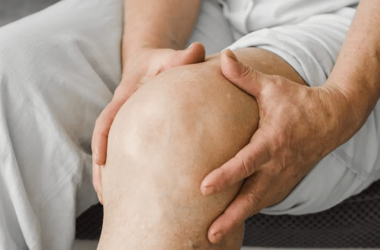 Tanda Flare Lupus yang Sering Diabaikan: Waspada Nyeri Sendi Ringan dan&nbsp;Subklinis!