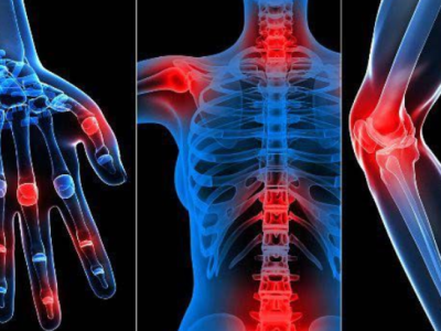 Kenali Tanda Nyeri Sendi Karena&nbsp;Autoimun